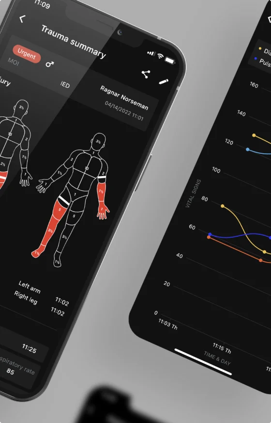 To mobilskjermer viser en applikasjon som analyserer fysisk traume